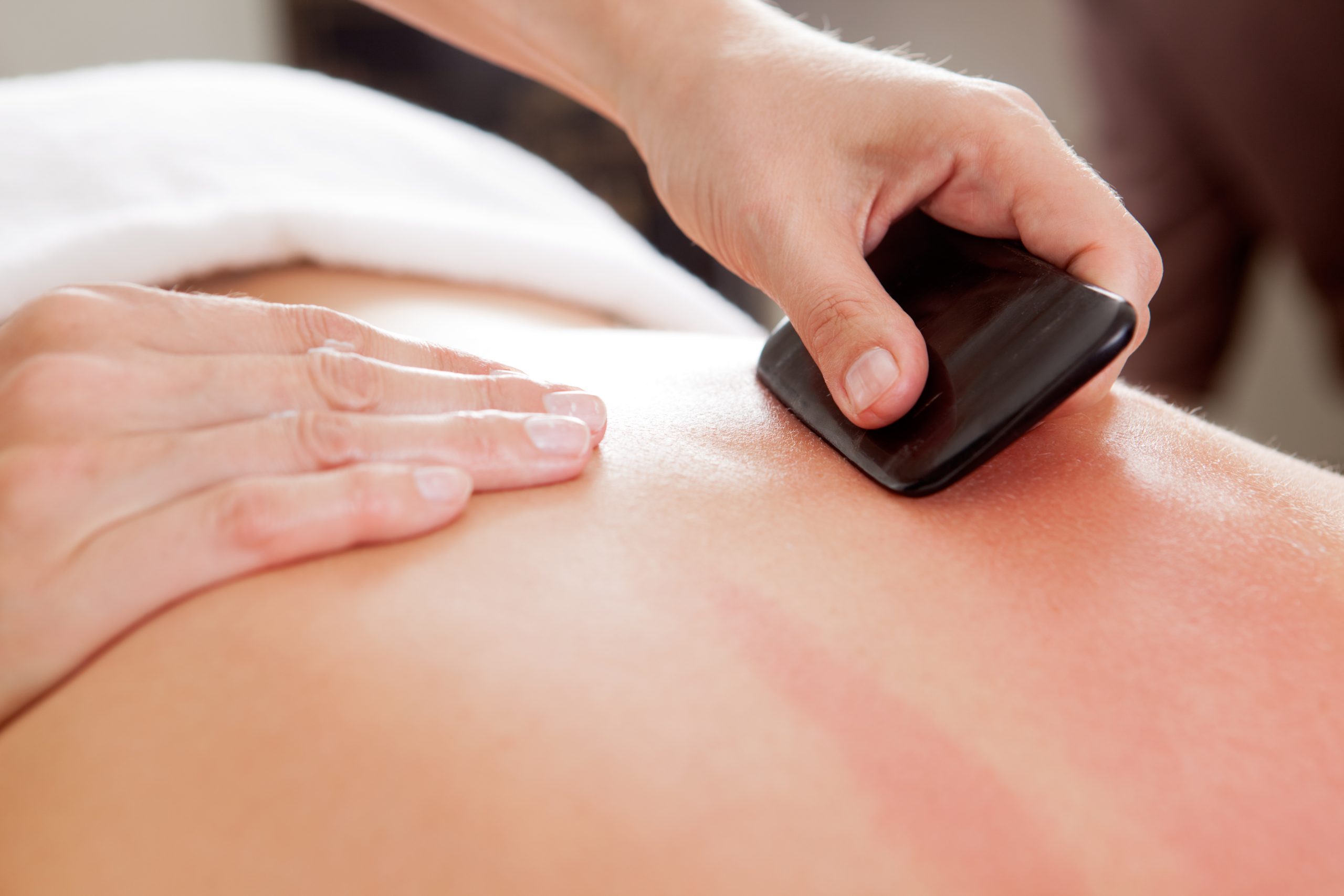 Therapist using a gua sha stone on a client's reddened back for muscle relaxation and pain relief in NE Portland.